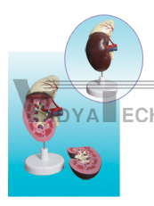 The expansion model of kidney